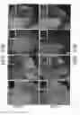 Fig. 16 - Diarylpropionitrile therapy for treatment of multiple sclerosis