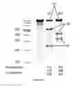 Fig. 09 - Method of treating multiple myeloma using natural killer cells expressing a chimeric antigen receptor for CD38