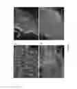 Fig. 08 - COMPOSITION FOR TREATING BRAIN LESIONS