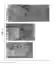 Fig. 02 - Methods and Related Kits for Treating and Regenerating Tooth Pulp and Periapical Tissues in a Mammal
