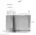 Fig. 05 - Controlled release system for pulmonary delivery of surfactant protein D