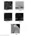 Fig. 04 - Method of treating macular degeneration using botulinum toxin-based pharmaceuticals