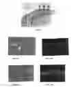 Fig. 06 - Method of treating macular degeneration using botulinum toxin-based pharmaceuticals