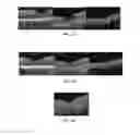 Fig. 09 - Method of treating macular degeneration using botulinum toxin-based pharmaceuticals