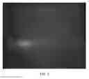 Fig. 06 - SIZE TUNABLE MICROBIAL MIMETICS FOR IMMUNOTHERAPY OF THYROID CARCINOMAS AND SOLID TUMORS
