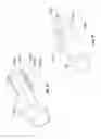 Fig. 33 - Safety needle devices