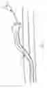 Fig. 02 - Temporary retention device