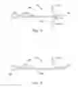 Fig. 07 - Temporary retention device
