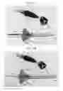 Fig. 07 - INTRAVENOUS CATHETER STOPPER