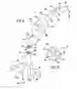 Fig. 08 - Occluding catheter and dynamic method for prevention of stroke