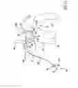 Fig. 09 - Occluding catheter and dynamic method for prevention of stroke