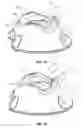 Fig. 09 - Systems and methods for radiographically identifying an access port