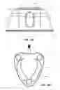 Fig. 46 - Systems and methods for radiographically identifying an access port