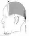 Fig. 02 - Scalp-Mounted Sensory Prosthesis and Method of Use