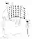 Fig. 07 - Scalp-Mounted Sensory Prosthesis and Method of Use