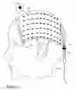 Fig. 08 - Scalp-Mounted Sensory Prosthesis and Method of Use