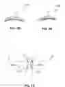 Fig. 08 - EXTRANASAL STIMULATION DEVICES AND METHODS
