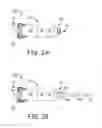 Fig. 03 - Input switching in a ventricular intracardiac pacemaker