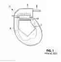 Fig. 02 - Feedthrough of an implantable medical electronic device