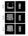 Fig. 04 - MRI-CT compatible dynamic motion phantom