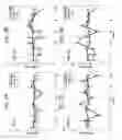Fig. 06 - MRI-CT compatible dynamic motion phantom