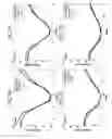 Fig. 08 - MRI-CT compatible dynamic motion phantom