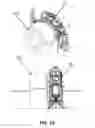 Fig. 14 - Radiation therapy systems and methods