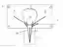 Fig. 01 - Breaststroke leg strength training device