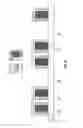 Fig. 06 - Casino Speed Reader