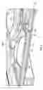 Fig. 06 - INSTRUMENT AND CARTRIDGE FOR PERFORMING ASSAYS IN A CLOSED SAMPLE PREPARATION AND REACTION SYSTEM EMPLOYING ELECTROWETTING FLUID MANIPULATION