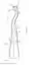 Fig. 07 - Sealant-applicator tips
