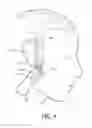 Fig. 05 - Hair trimmer with cutting guide