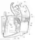 Fig. 01 - AUTOMATED INFLATION DEVICE