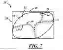 Fig. 04 - Vehicle interior panel with sealed perforations
