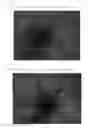 Fig. 09 - Fluorescent probe for detecting calpain activity