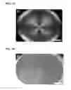 Fig. 03 - Dendritic macroporous hydrogels prepared by crystal templating