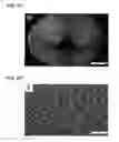 Fig. 14 - Dendritic macroporous hydrogels prepared by crystal templating