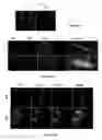 Fig. 10 - AUF1 ENCODING COMPOSITIONS FOR MUSCLE CELL UPTAKE, SATELLITE CELL POPULATIONS, AND SATELLITE CELL MEDIATED MUSCLE GENERATION