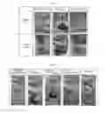 Fig. 02 - Medium composition for preparing botulinum toxin