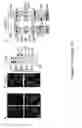 Fig. 02 - TRIM11 for degradation of protein aggregates