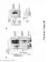 Fig. 12 - TRIM11 for degradation of protein aggregates