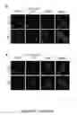 Fig. 20 - TRIM11 for degradation of protein aggregates