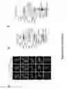Fig. 26 - TRIM11 for degradation of protein aggregates
