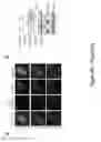 Fig. 28 - TRIM11 for degradation of protein aggregates