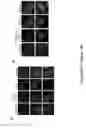Fig. 48 - TRIM11 for degradation of protein aggregates