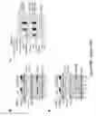 Fig. 55 - TRIM11 for degradation of protein aggregates