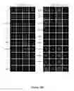 Fig. 58 - TRIM11 for degradation of protein aggregates
