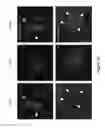 Fig. 64 - TRIM11 for degradation of protein aggregates
