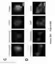 Fig. 71 - TRIM11 for degradation of protein aggregates