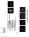 Fig. 90 - TRIM11 for degradation of protein aggregates